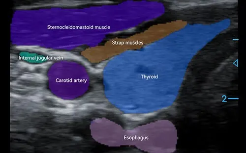 Periodmed Aura PAU2A — miniatura 6