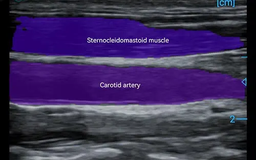 Periodmed Aura PAU2A — miniatura 7