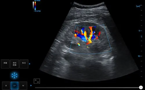 Periodmed Aura PAU2A — miniatura 8